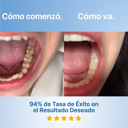 Galnex Tooth Repairing Powder