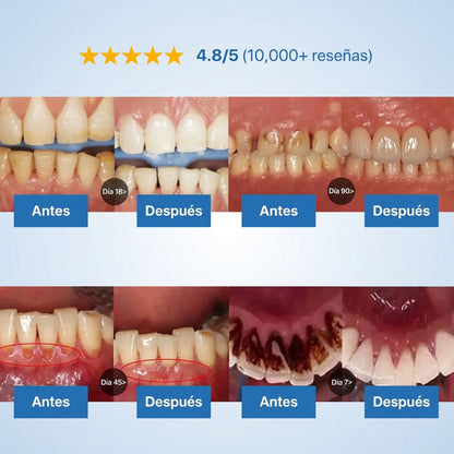 Galnex Tooth Repairing Powder